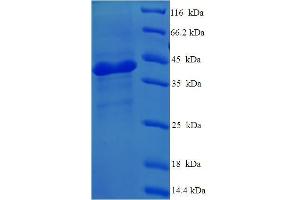 SDS-PAGE (SDS) image for Complement Component 1, Q Subcomponent, A Chain (C1QA) (AA 23-245) protein (His-SUMO Tag) (ABIN5709163) (C1QA Protein (AA 23-245) (His-SUMO Tag))