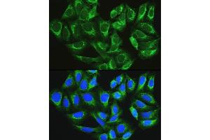 Immunofluorescence (IF) image for anti-ATG16 Autophagy Related 16-Like 1 (ATG16L1) (AA 200-300) antibody (ABIN6137248)