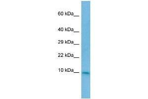 WB Suggested Anti-CC2D2A Antibody Titration: 1. (CC2D2A antibody  (N-Term))