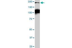 CDC42BPB monoclonal antibody (M04), clone 2D8. (CDC42BPB antibody  (AA 1580-1679))