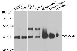 Western blot analysis of extracts of various cell lines, using ACADS antibody (ABIN5970342) at 1/1000 dilution. (ACADS antibody)