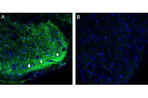 Expression of CRMP2 in rat spinal cord. (DPYSL2 antibody  (Intracellular))