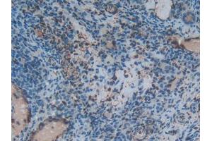 Used in DAB staining on fromalin fixed paraffin-embedded lung tissue