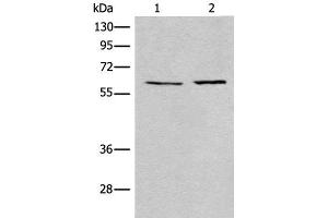 Western blot analysis of A172 and Jurkat cell lysates using USP14 Polyclonal Antibody at dilution of 1:400 (USP14 antibody)
