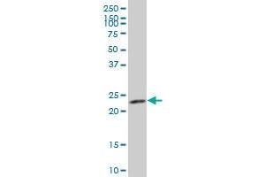 ARFRP1 polyclonal antibody (A01), Lot # ABNOVA060620QCS1 Western Blot analysis of ARFRP1 expression in HepG2 ( Cat # L019V1 ). (ARFRP1 antibody  (AA 133-201))