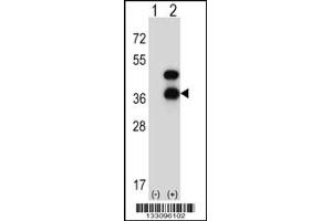 Western blot analysis of CD72 using rabbit polyclonal CD72 Antibody using 293 cell lysates (2 ug/lane) either nontransfected (Lane 1) or transiently transfected (Lane 2) with the CD72 gene. (CD72 antibody  (AA 176-203))