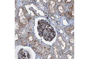 Immunohistochemical staining (Formalin-fixed paraffin-embedded sections) of human kidney with DYSF polyclonal antibody  shows strong positivity in the glomeruli and moderate membranous staining in tubular cells.