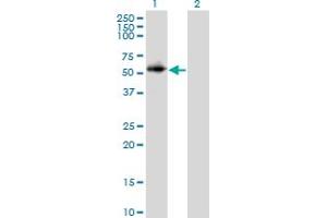 Western Blot analysis of PPP2R2C expression in transfected 293T cell line by PPP2R2C monoclonal antibody (M01), clone 6D1. (PPP2R2C antibody  (AA 1-110))