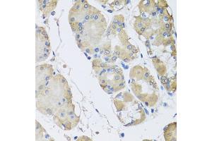 Immunohistochemistry of paraffin-embedded human stomach using RPLP1 antibody (ABIN5974064) at dilution of 1/100 (40x lens). (RPLP1 antibody)