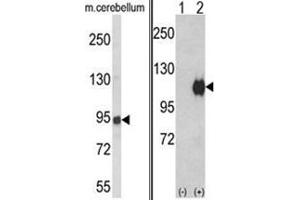 (LEFT) Western blot analysis of ENPP2 Antibody (Center) in mouse cerebellum tissue lysates (35ug/lane). (ENPP2 antibody  (Middle Region))