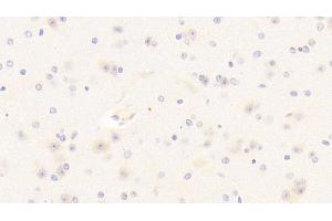 Detection of PDGF BB in Mouse Cerebrum Tissue using Polyclonal Antibody to Platelet Derived Growth Factor BB (PDGF BB) (PDGF-BB Homodimer (AA 21-241) antibody)