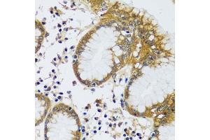 Immunohistochemistry of paraffin-embedded human stomach using CAMLG antibody (ABIN6129359, ABIN6137896, ABIN6137897 and ABIN6217819) at dilution of 1:100 (40x lens). (CAMLG antibody  (AA 1-190))