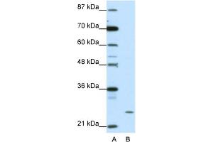 WB Suggested Anti-ZNF253 Antibody Titration:  1. (ZNF253 antibody  (C-Term))