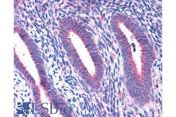 RPL22 antibody  (C-Term)