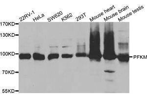 Western blot analysis of extracts of various cell lines, using PFKM antibody (ABIN5973190) at 1/1000 dilution. (PFKM antibody)