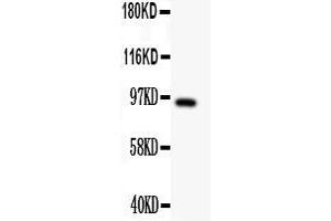 Anti- DISC1 antibody, Western blottingAll lanes: Anti DISC1  at 0. (DISC1 antibody  (Middle Region))