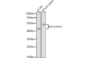 Western blot analysis of extracts of various cell lines, using β-arrestin1 antibody (ABIN6127452, ABIN6137135, ABIN6137136 and ABIN6213655) at 1:1000 dilution. (beta Arrestin 1 antibody  (AA 169-418))