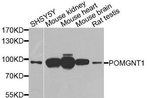 Western blot analysis of extracts of various cell lines, using POMGNT1 antibody (ABIN6003611) at 1/1000 dilution. (POMGNT1 antibody)