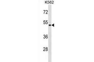 Western Blotting (WB) image for anti-Enolase Superfamily Member 1 (ENOSF1) antibody (ABIN2998739)