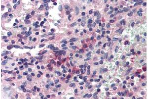Human Spleen (formalin-fixed, paraffin-embedded) stained with SAE1 antibody ABIN214379 at 5 ug/ml followed by biotinylated goat anti-rabbit IgG secondary antibody ABIN481713, alkaline phosphatase-streptavidin and chromogen. (SAE1 antibody)
