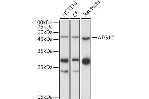 Western blot analysis of extracts of various cell lines, using  antibody (ABIN7265789) at 1:1000 dilution. (ATG12 antibody  (AA 1-74))