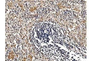 IHC analysis of GFPT1 using anti-GFPT1 antibody (ABIN7602887).