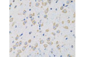 Immunohistochemistry of paraffin-embedded Mouse brain using MSRA Polyclonal Antibody at dilution of 1:100 (40x lens). (MSRA antibody)