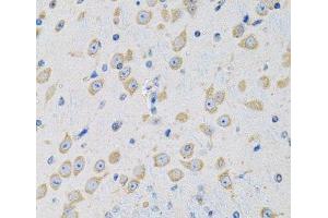 Immunohistochemistry of paraffin-embedded Mouse brain using MSRA Polyclonal Antibody at dilution of 1:100 (40x lens).