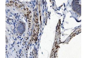 IHC analysis of PTBP2 using anti-PTBP2 antibody (ABIN7599454). (PTBP2 antibody  (AA 1-504))