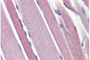 Human Skeletal Muscle (formalin-fixed, paraffin-embedded) stained with HK2 antibody ABIN462257 followed by biotinylated goat anti-rabbit IgG secondary antibody ABIN481713, alkaline phosphatase-streptavidin and chromogen. (Hexokinase 2 antibody  (AA 74-123))