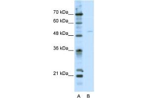 WB Suggested Anti-TFEB Antibody Titration:  2. (TFEB antibody  (C-Term))