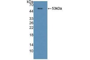 Western blot analysis of recombinant Human CPR.