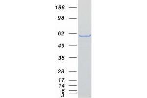Validation with Western Blot (CORO2A Protein (Transcript Variant 2) (Myc-DYKDDDDK Tag))
