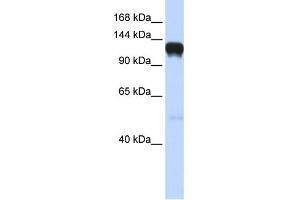 WB Suggested Anti-EPHA5 Antibody Titration: 0. (EPH Receptor A5 antibody  (Middle Region))