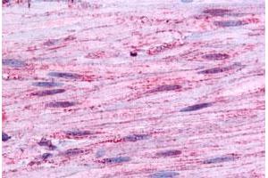 Immunohistochemical staining of human smooth muscle with BDKRB1 polyclonal antibody . (BDKRB1 antibody  (Extracellular Domain))