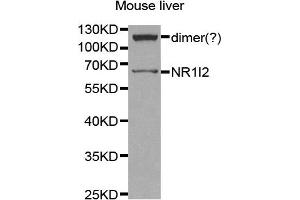 Western Blotting (WB) image for anti-Nuclear Receptor Subfamily 1, Group I, Member 2 (NR1I2) antibody (ABIN1873949)