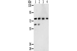 Gel: 6 % SDS-PAGE, Lysate: 40 μg, Lane 1-4: A549 cells, hepg2 cells, lovo cells, A431 cells, Primary antibody: ABIN7131407(TMPRSS7 Antibody) at dilution 1/250, Secondary antibody: Goat anti rabbit IgG at 1/8000 dilution, Exposure time: 5 minutes (TMPRSS7 antibody)