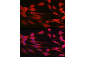 Immunofluorescence (IF) image for anti-Ribosomal Protein S6 Kinase, 70kDa, Polypeptide 1 (RPS6KB1) (AA 1-352) antibody (ABIN3023169)