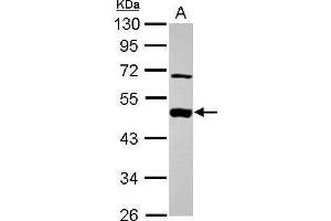 WB Image Sample (30 ug of whole cell lysate) A: A431 , 10% SDS PAGE antibody diluted at 1:1000 (MEK2 antibody)