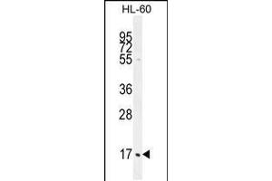 Western blot analysis in HL-60 cell line lysates (35ug/lane). (C1QC antibody  (AA 93-120))