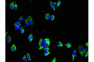 Immunofluorescent analysis of HepG2 cells using ABIN7159316 at dilution of 1:100 and Alexa Fluor 488-congugated AffiniPure Goat Anti-Rabbit IgG(H+L) (Melatonin Receptor 1B antibody  (AA 1-42))