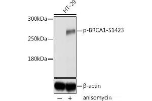 Western blot analysis of extracts of HT-29 cells using Phospho-BRCA1(S1423) Polyclonal Antibody at dilution of 1:2000.
