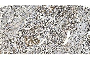 IHC analysis of NOX2/gp91phox/CYBB using anti-NOX2/gp91phox/CYBB antibody (ABIN7599875). (CYBB antibody  (AA 124-559))