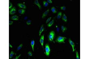 Immunofluorescent analysis of Hela cells using ABIN7147825 at dilution of 1:100 and Alexa Fluor 488-congugated AffiniPure Goat Anti-Rabbit IgG(H+L) (Clarin 3 antibody  (AA 39-91))