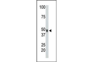 The anti-CHK Pab (ABIN391080 and ABIN2841225) is used in Western blot to detect CHK in mouse heart tissue lysate. (MATK antibody  (N-Term))