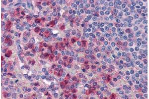 Human Spleen, Neutrophils (formalin-fixed, paraffin-embedded) stained with IL27 antibody ABIN351442 at 5 ug/ml followed by biotinylated goat anti-rabbit IgG secondary antibody ABIN481713, alkaline phosphatase-streptavidin and chromogen. (IL-27 antibody  (Internal Region))