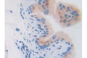 Immunohistochemistry (IHC) image for anti-Glucose-6-Phosphate Isomerase (GPI) (AA 308-558) antibody (ABIN1859056)