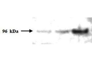 Western Blotting (WB) image for anti-PMS2 Postmeiotic Segregation Increased 2 (S. Cerevisiae) (PMS2) (AA 58-81) antibody (ABIN400795) (PMS2 antibody  (AA 58-81))