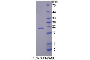SDS-PAGE (SDS) image for NADPH Oxidase 4 (NOX4) (AA 220-392) protein (His tag) (ABIN1171039) (NADPH Oxidase 4 Protein (NOX4) (AA 220-392) (His tag))