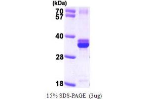 SDS-PAGE (SDS) image for Nudix (Nucleoside Diphosphate Linked Moiety X)-Type Motif 5 (NUDT5) (AA 1-219) protein (His tag) (ABIN667154) (NUDT5 Protein (AA 1-219) (His tag))